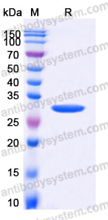 YHD97402, SDS-PAGE