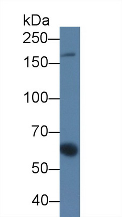 14674