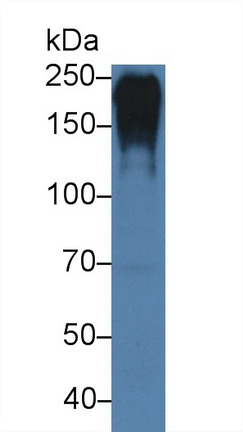 14271