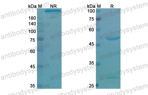 Валидация SDS-PAGE - AntibodySystem DHB65402