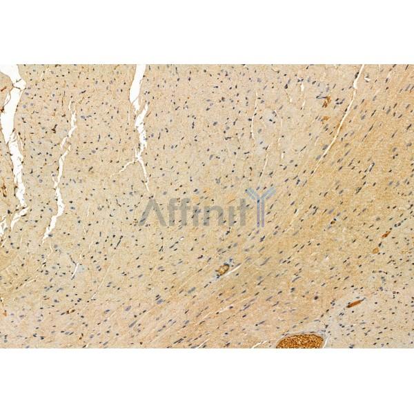 Валидация Affinity DF12047 - 6094