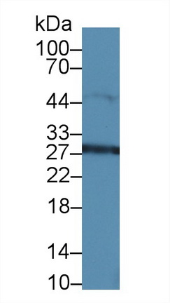 14633