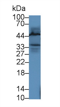 12944