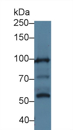 14213