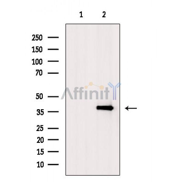 Валидация Affinity AF6570 - 3877