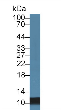 14521