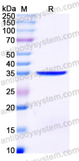 YHG97401, SDS-PAGE