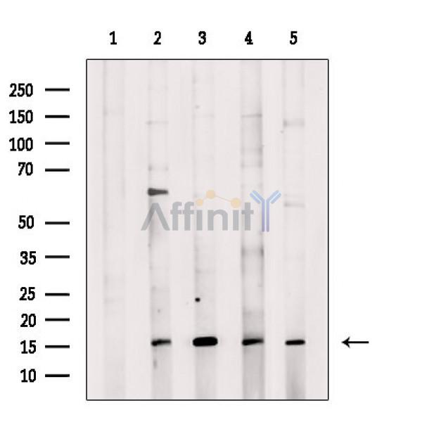 Валидация Affinity DF3593 - 14554