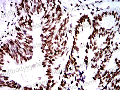 Валидация AntibodySystem RHN95901