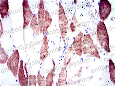 Валидация AntibodySystem RHD57803