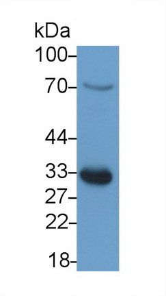 21236