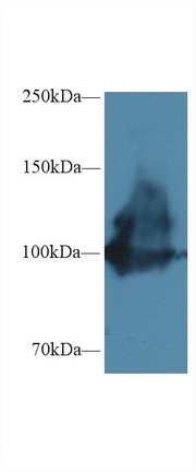 14540