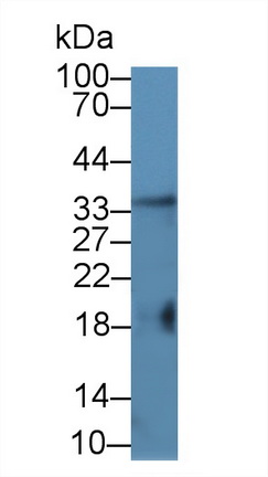 12954