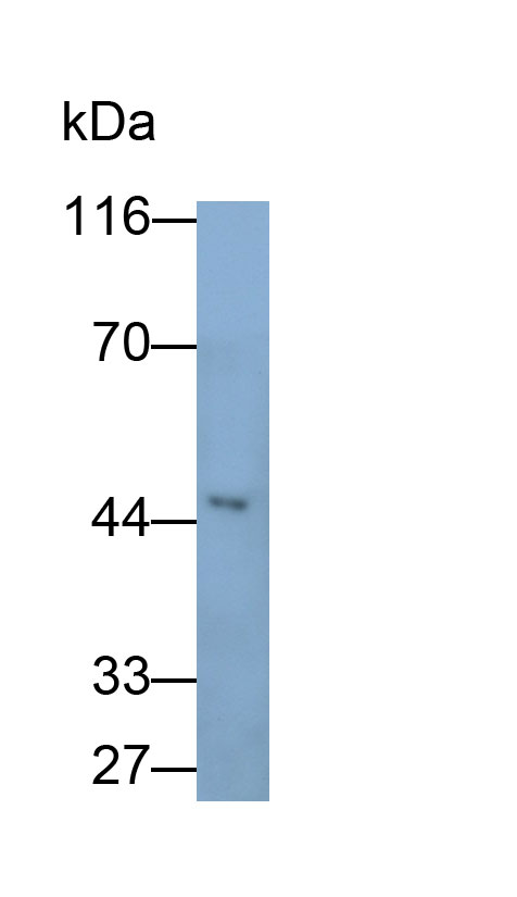 31652
