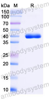 Валидация SDS-PAGE - AntibodySystem RHB93301