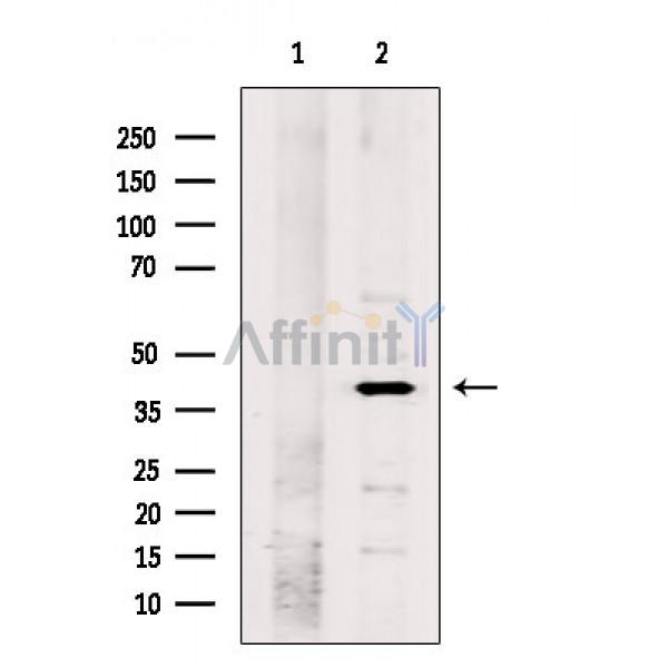 Валидация Affinity DF8149 - 20002