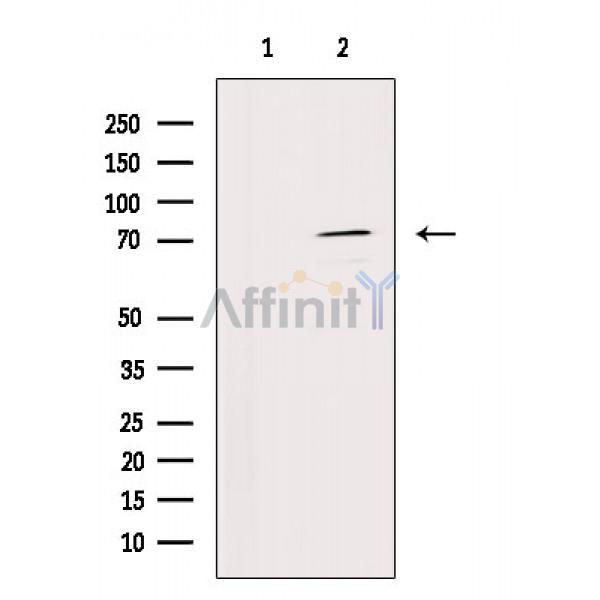 Валидация Affinity DF2508 - 13161