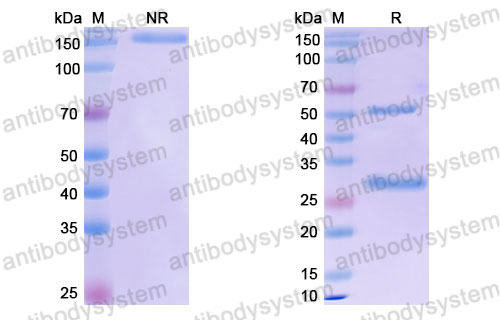 Валидация SDS-PAGE - AntibodySystem FHJ92510