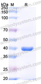 AHA00702, SDS-PAGE