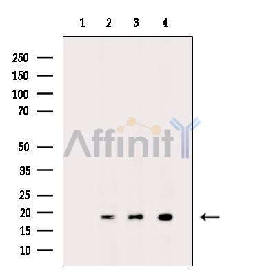 Валидация Affinity DF15200 - 11468