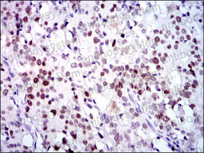 Валидация AntibodySystem RHD64705 (1688)