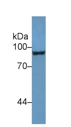 9152