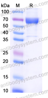 EHB05702, SDS-PAGE