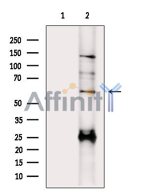 Валидация Affinity DF15007 - 11215