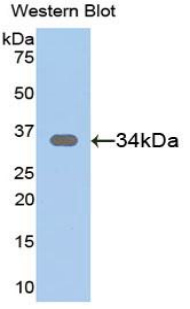 41621