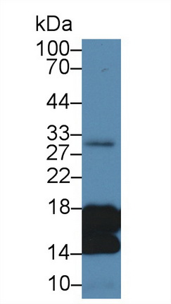 17587