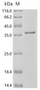 SDS-PAGE