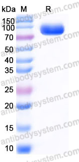 EHJ63403, SDS-PAGE