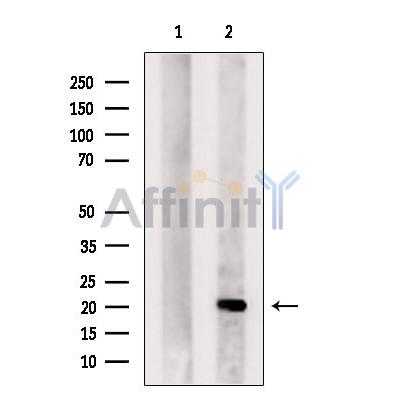 Валидация Affinity DF6495 - 17890