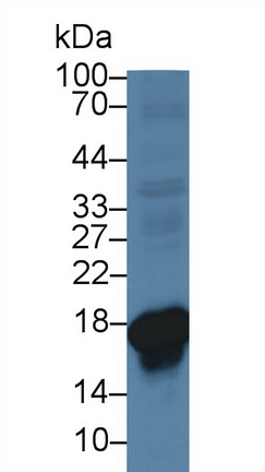 14015