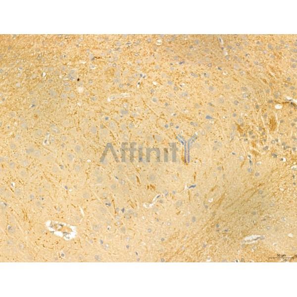 Валидация Affinity AF4085 - 2146