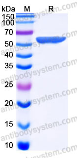 EHC88401, SDS-PAGE