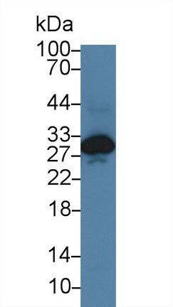 14270
