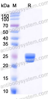 EHA34902, SDS-PAGE
