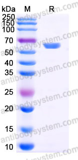 AHD11502, SDS-PAGE