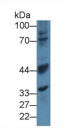 12360