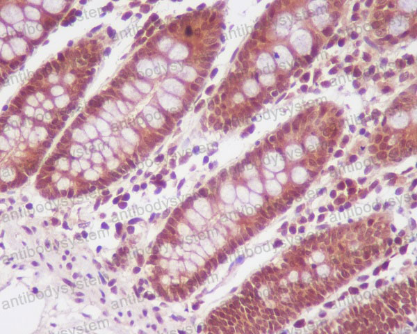 Валидация AntibodySystem RHF52601