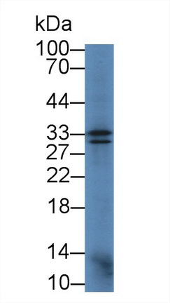 14948