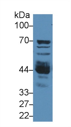 14601