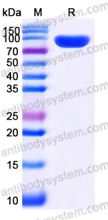EHJ58901, SDS-PAGE
