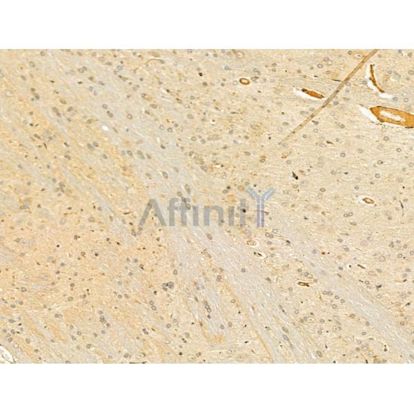 Валидация Affinity DF13071 - 7938