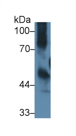 14881