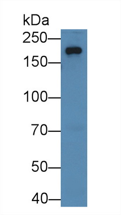 12910