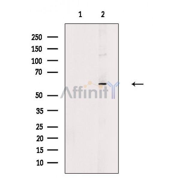 Валидация Affinity DF9227 - 21639