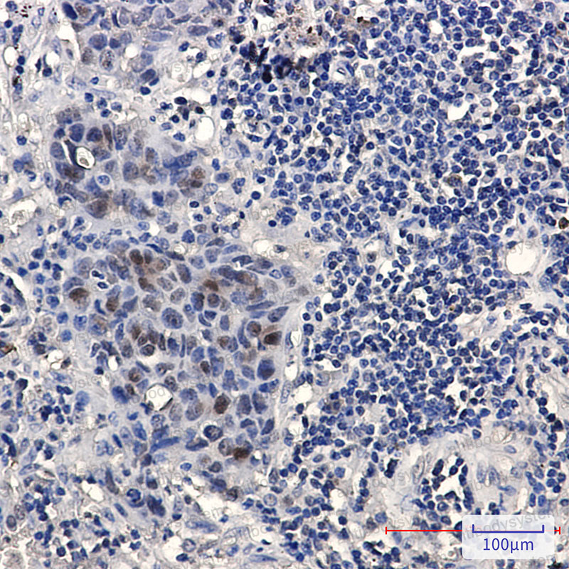 Валидация AntibodySystem RHA49701 (147)