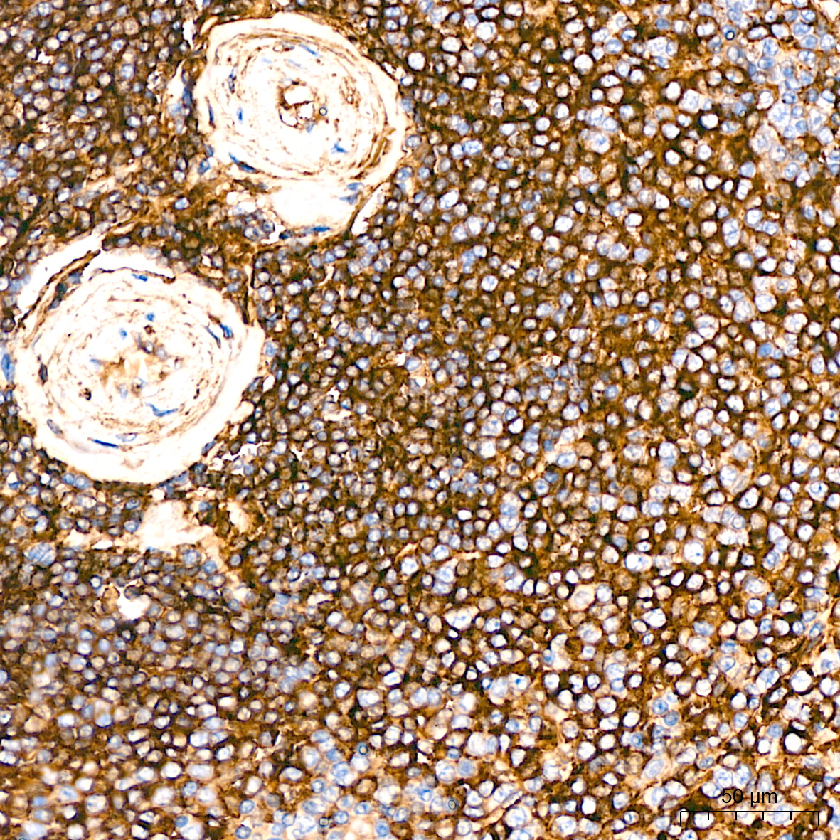 A25914, иммуногистохимия, ткань селезенки человека (9724)